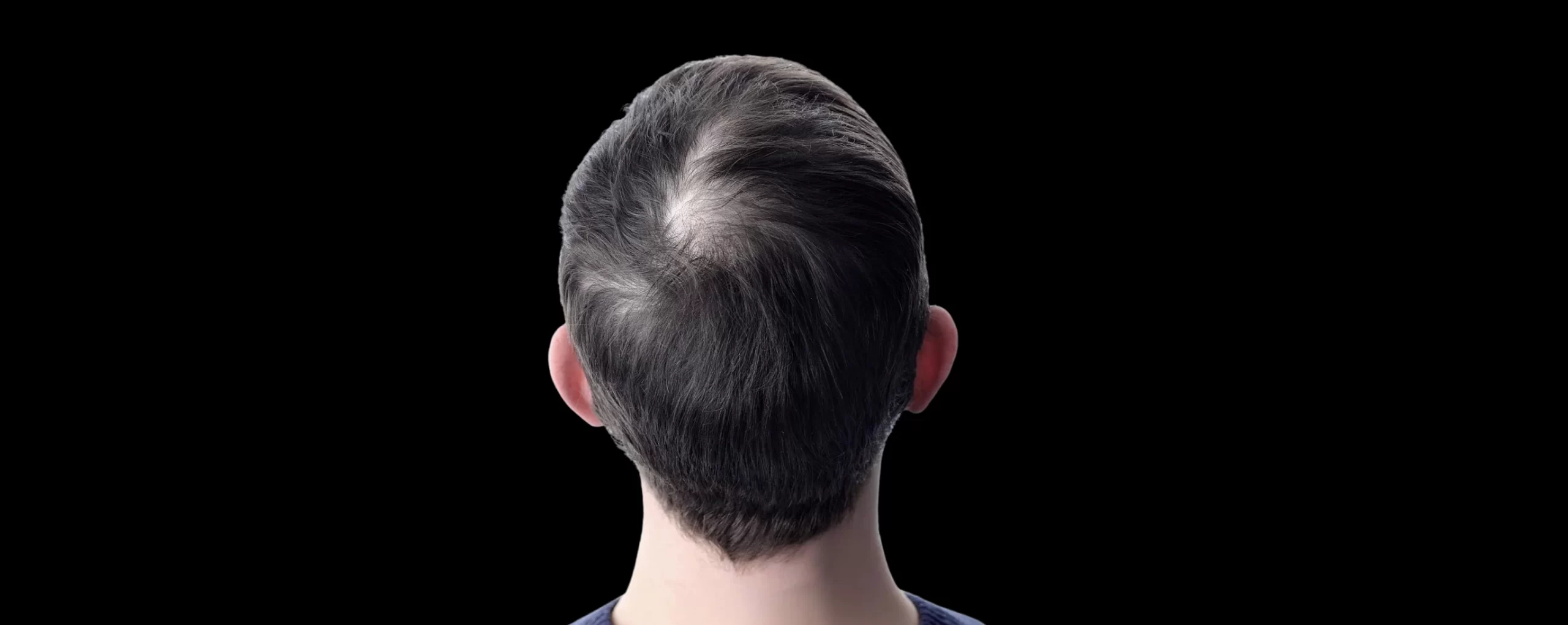 Before Results Image